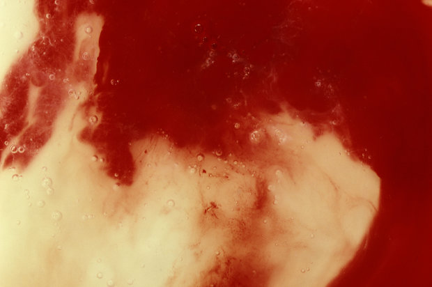 Andres Serrano (born 1950,) Blood and Semen III, 1990. Chromogenic color print, edition 1 of 4, 40 × 60 inches. Courtesy of the artist.